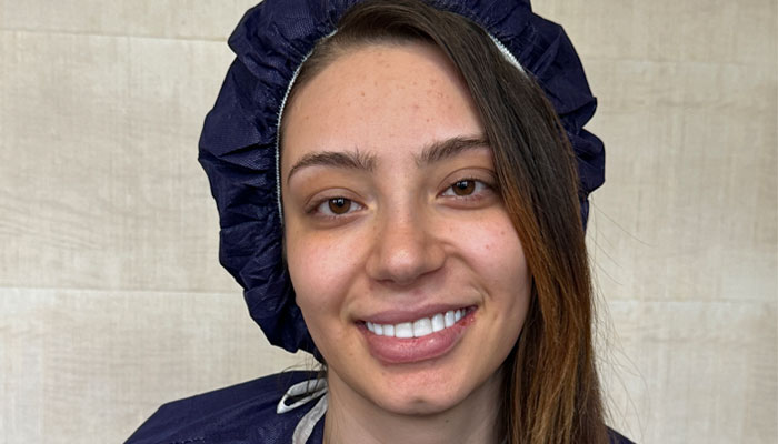 نمونه-کار-دکتر-لیلا-نوری-قبل-از-عمل