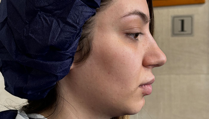 نمونه-کار-دکتر-لیلا-نوری-نیم-رخ