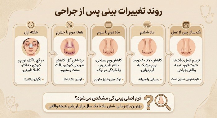 فرم اصلی بینی بعد از عمل کی مشخص می شود؟ 2 روند تغییرات بینی پس از جراحی