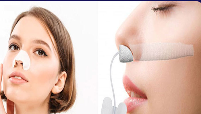 عمل بینی با تامپون بهتر است یا بدون تامپون؟ 4 مقایسه-تامپون-و-اسپلینت-سیلیکونی