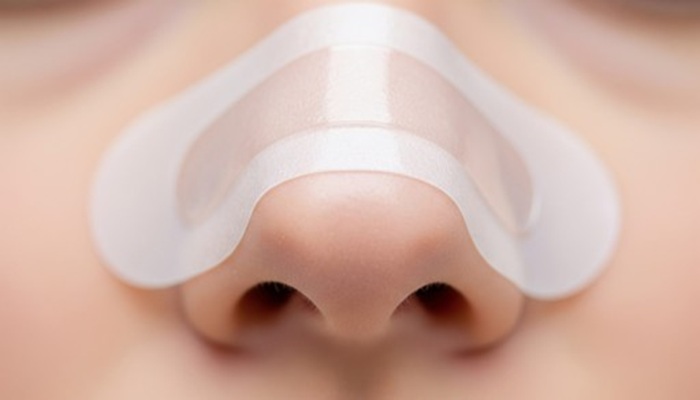 بهترین چسب بینی 2 اهمیت چسب بینی در مراقبت پس از جراحی