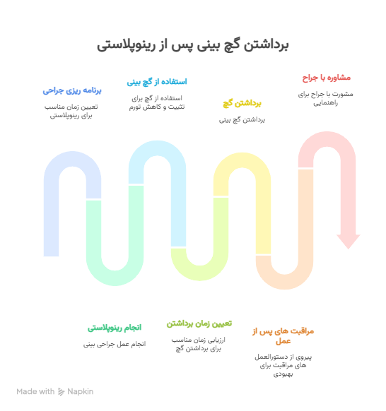 بهترین زمان برای برداشتن گچ بینی 2 گچ بینی