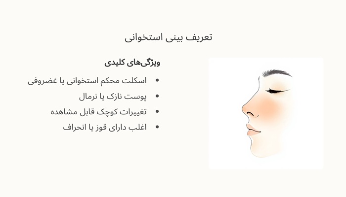 تعریف بینی استخوانی