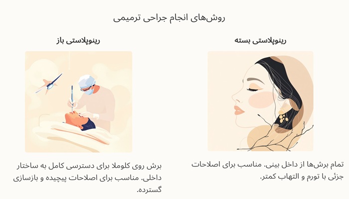 روش‌های انجام جراحی ترمیمی