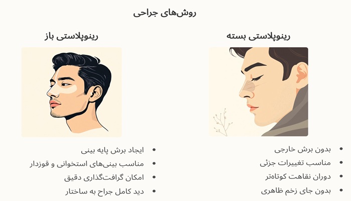 روش‌های جراحی بینی مردانه