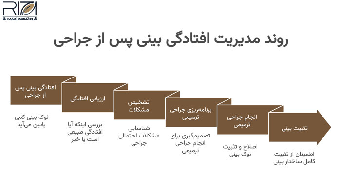 نوک بینی بعد از عمل چه قدر پایین میآید؟ 3 روند مدیریت افتادگی بینی پس از جراحی