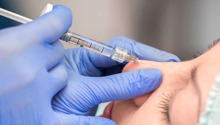 فیلر بینی برای چه کسانی مناسب است؟