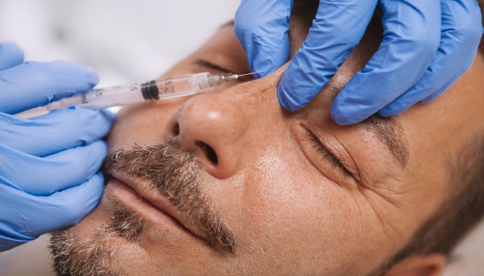 فیلر بینی برای چه کسانی مناسب است؟ 4 فیلر بینی چیست؟