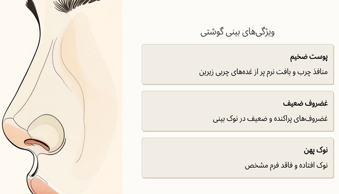 هزینه عمل بینی گوشتی 22 ویژگی های بینی گوشتی